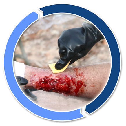 applying medication to skin wound